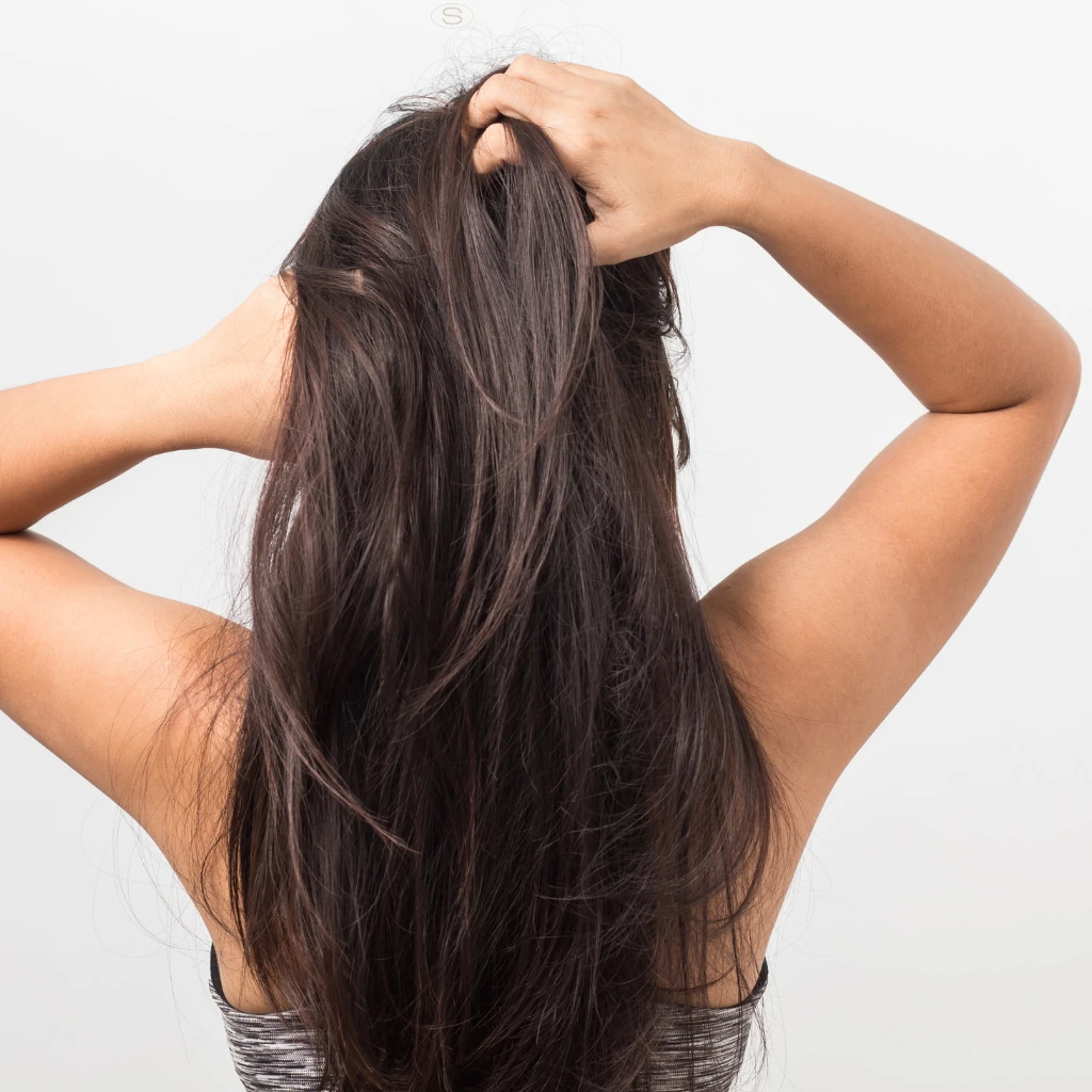 Doenças do couro cabeludo